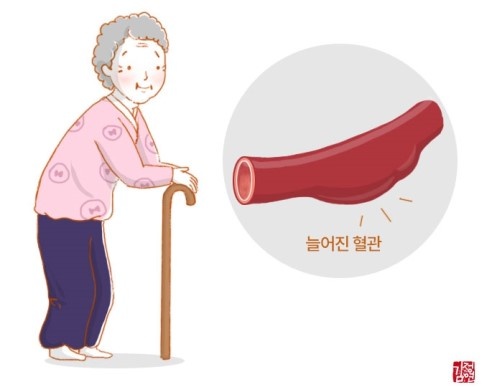 16_노화가-혈관에-어떤-영향을-끼치나요.jpg